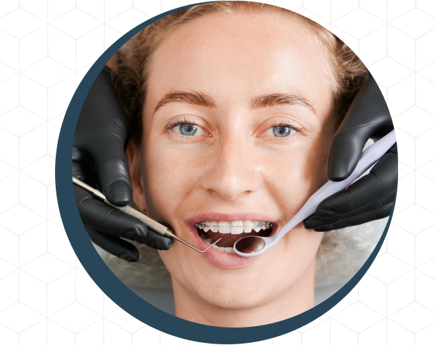 Hagyományos rögzített fogszabályozók kép Hagyományos rögzített fogszabályozók kép