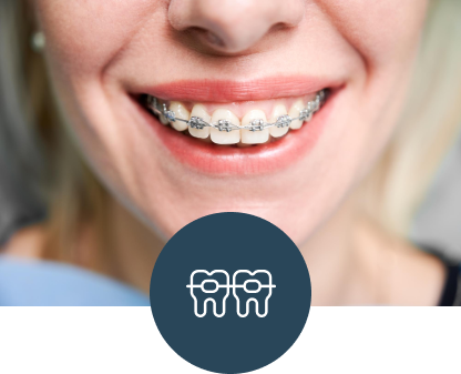 Rögzített fogszabályozók